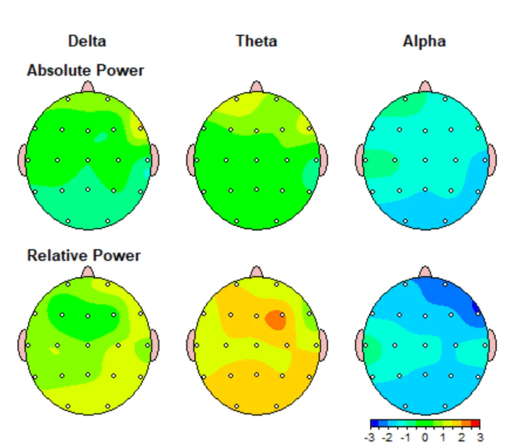 qEEG Brain Mapping Tampa Bay