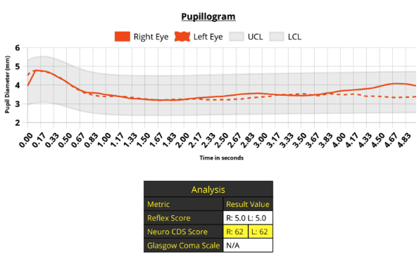 Pupil Testing in Tampa Florida