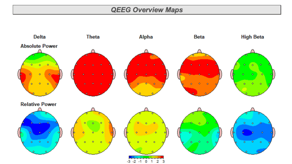 Tampa qEEG Brain Mapping