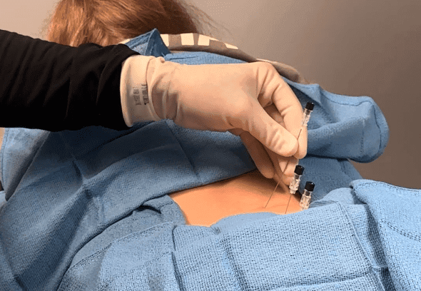 pain and brain specialist Tampa | Genesis Brain Institute