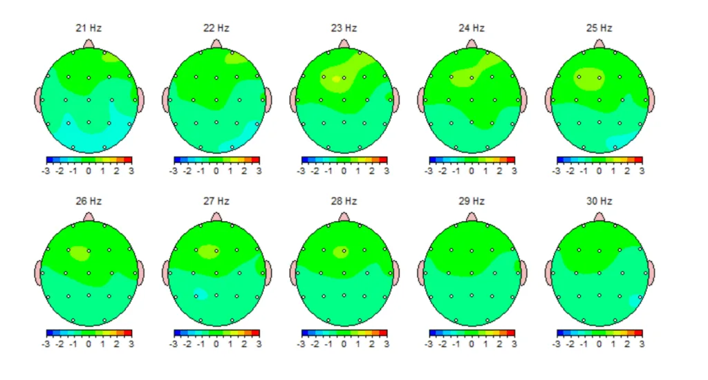 qeeg brain mapping results