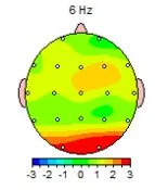 brain mapping adhd