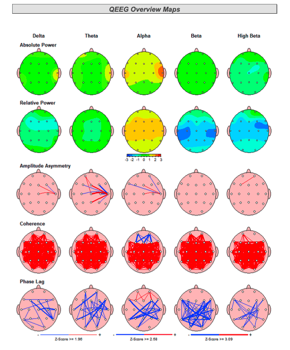 What is a brain map