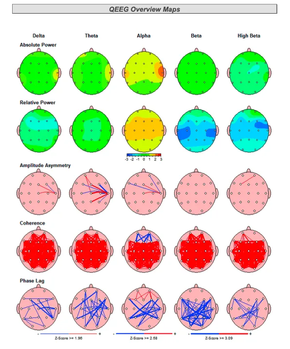 What is a brain map