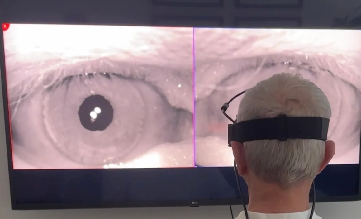 Eye Movement Testing In Tampa Fl