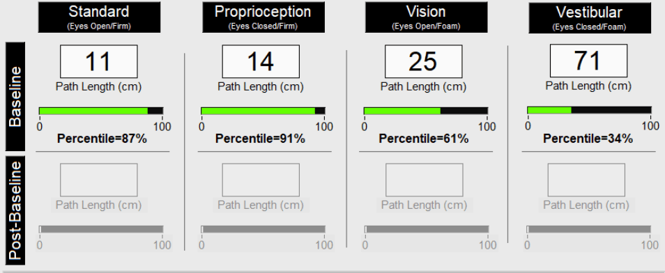 concussion balance test