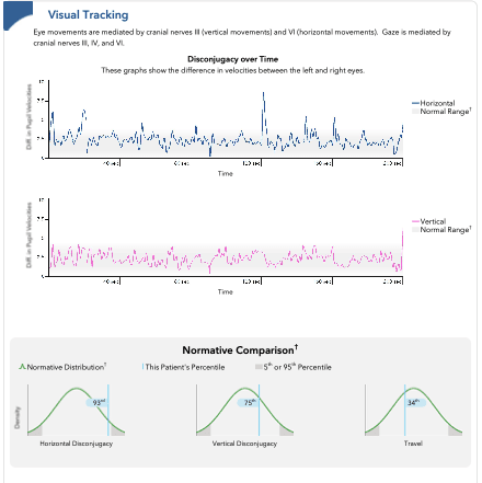 concussion testing research